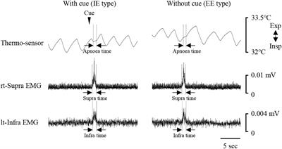 Coordination of Respiration, Swallowing, and Chewing in Healthy Young Adults